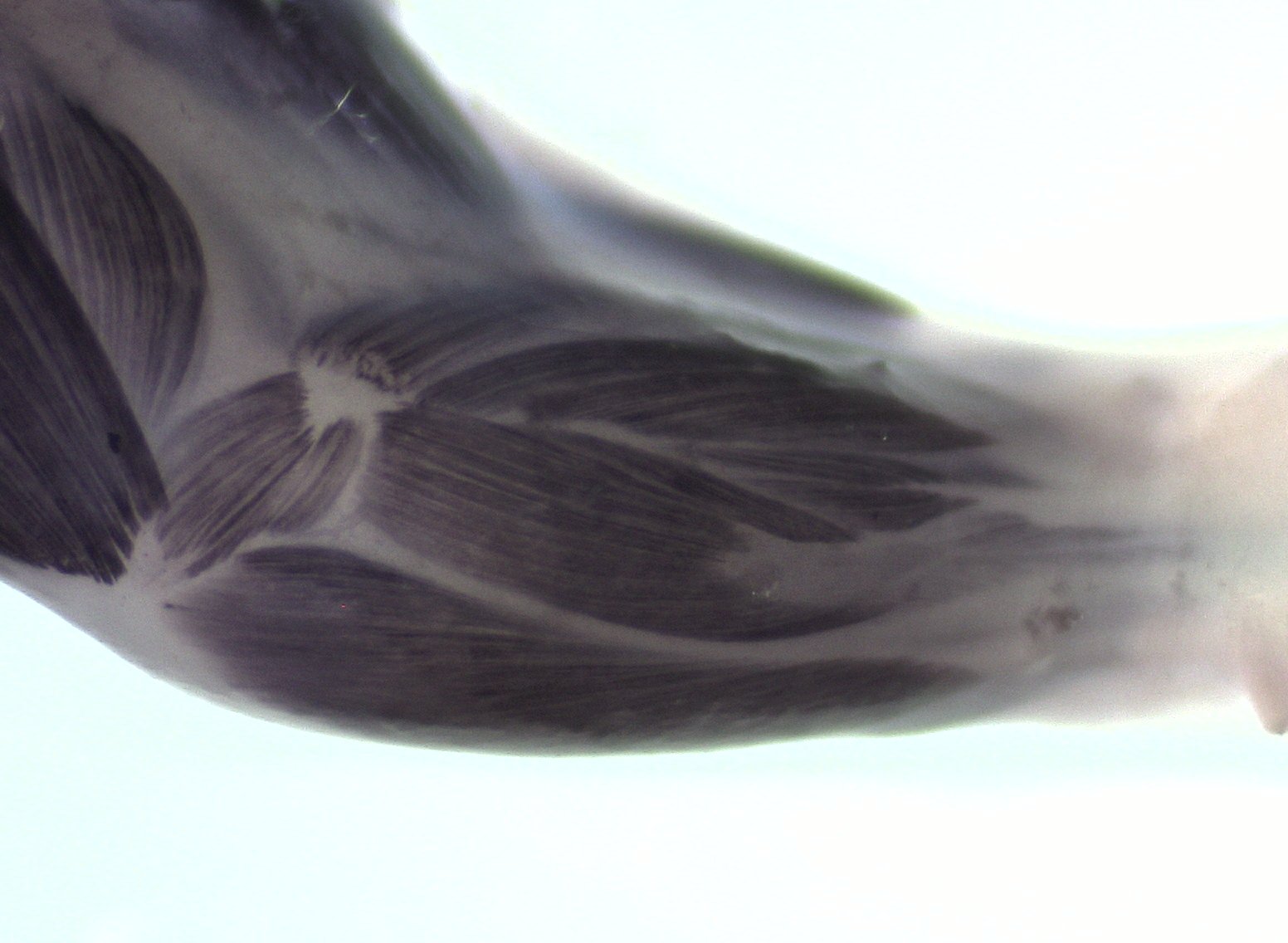 limb muscle