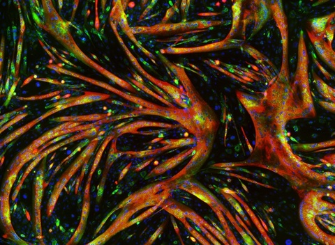 Image of myoblast fusion into myofibers