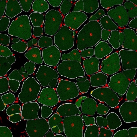 Image of skeletal muscle